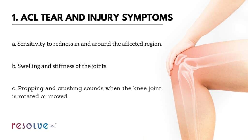 ACL Tear and Injury Symptoms