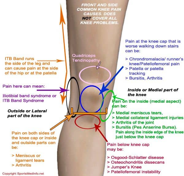 Causes of knee pain