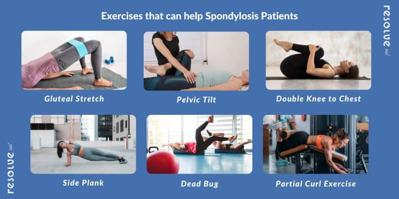 Exercises for Spondylosis