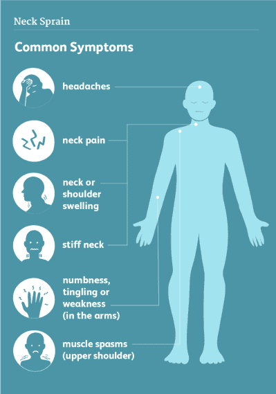 SYMPTOMS OF A NECK SPRAIN
