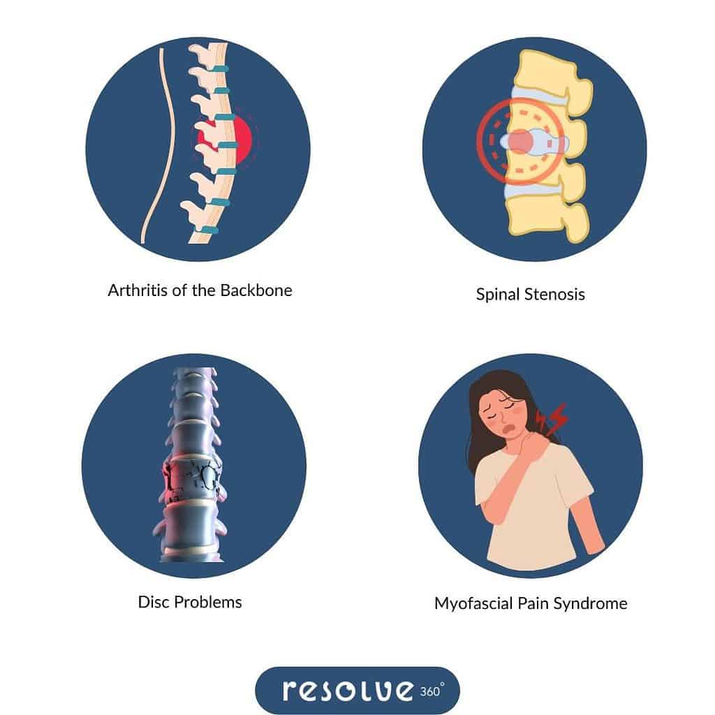 Causes of severe Back Pain1